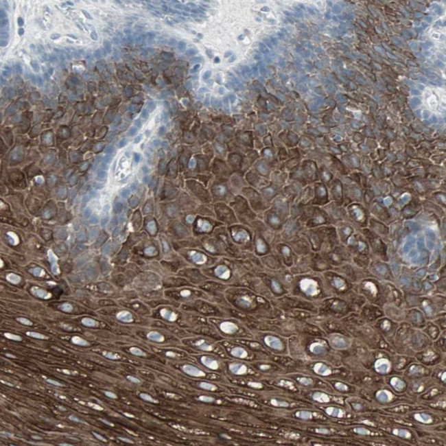 LANCL3 Antibody in Immunohistochemistry (Paraffin) (IHC (P))