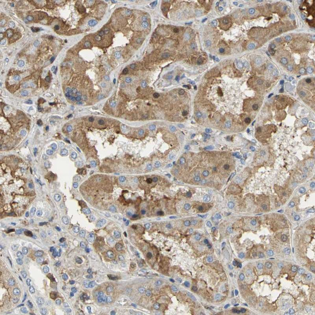 GYG2 Antibody in Immunohistochemistry (Paraffin) (IHC (P))