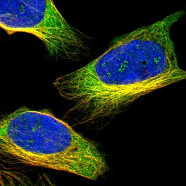 ZNF415 Antibody in Immunocytochemistry (ICC/IF)