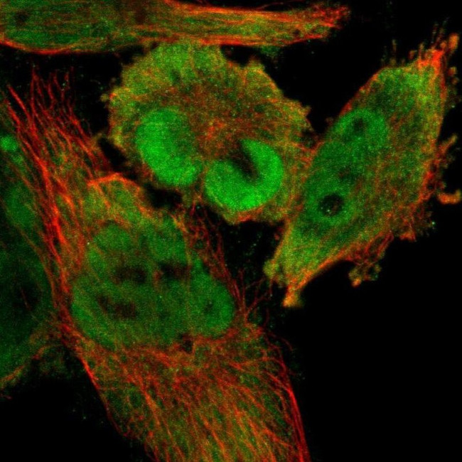 CDCA7 Antibody in Immunocytochemistry (ICC/IF)