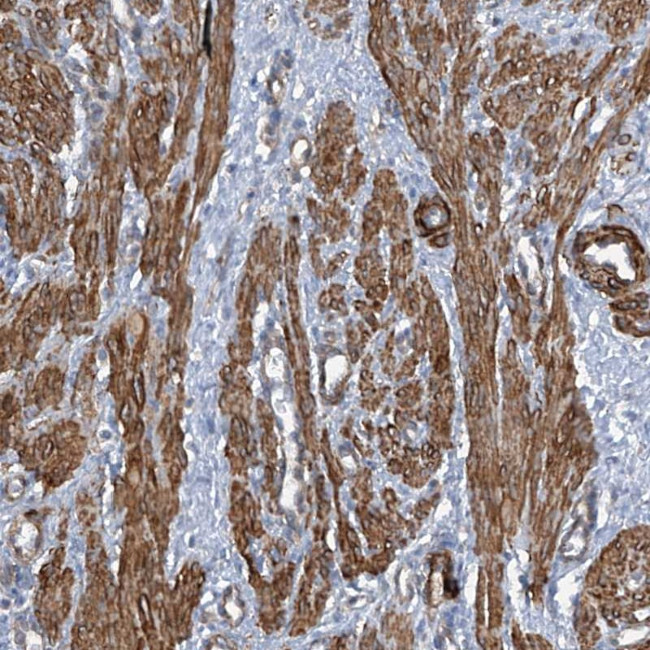 ZNF490 Antibody in Immunohistochemistry (Paraffin) (IHC (P))