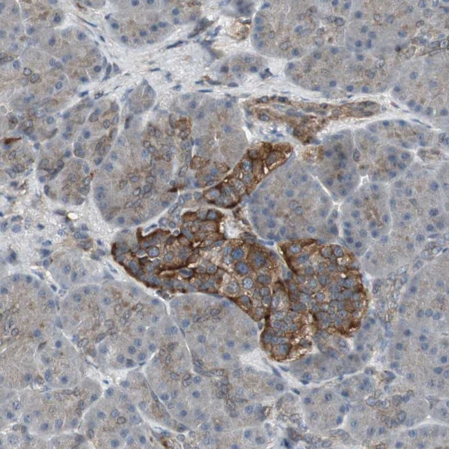 SCYL3 Antibody in Immunohistochemistry (Paraffin) (IHC (P))