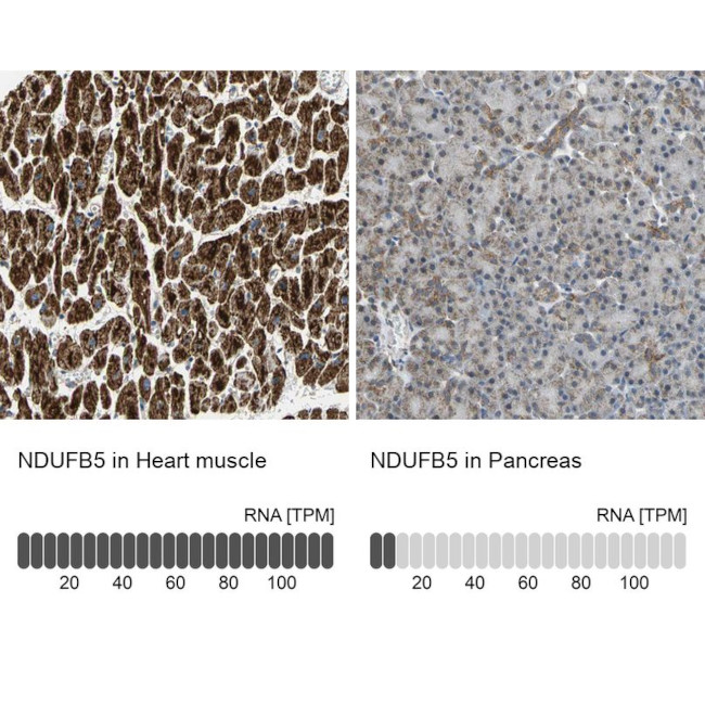 NDUFB5 Antibody in Immunohistochemistry (IHC)