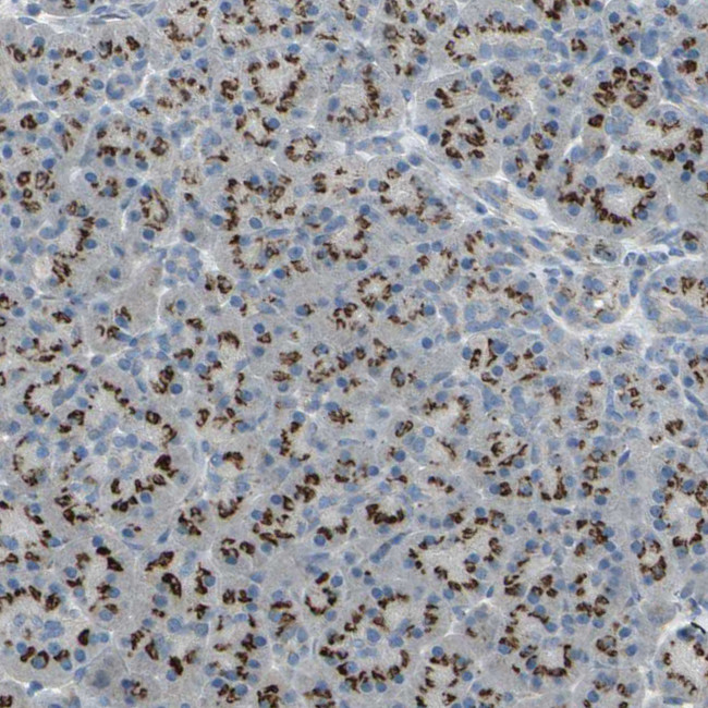 TM9SF2 Antibody in Immunohistochemistry (IHC)