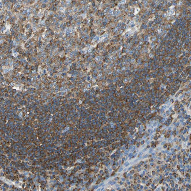 SEPT6 Antibody in Immunohistochemistry (Paraffin) (IHC (P))