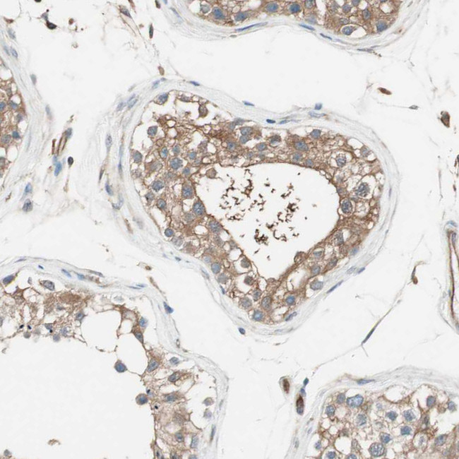 ITGBL1 Antibody in Immunohistochemistry (IHC)