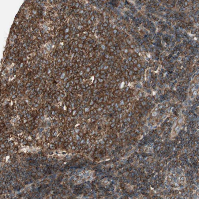 CHADL Antibody in Immunohistochemistry (Paraffin) (IHC (P))