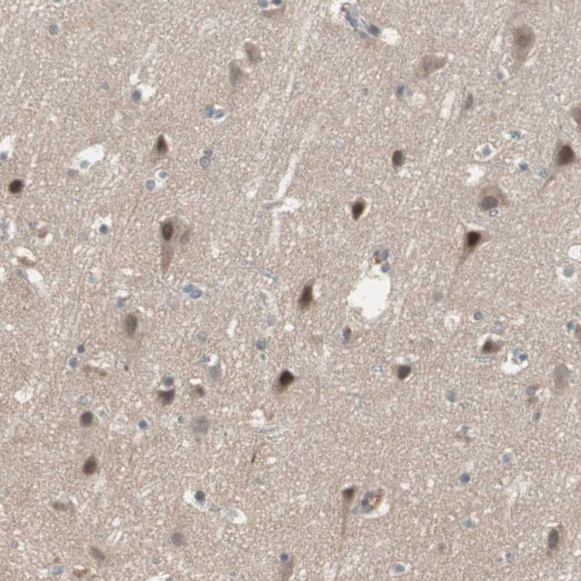 SNX4 Antibody in Immunohistochemistry (Paraffin) (IHC (P))