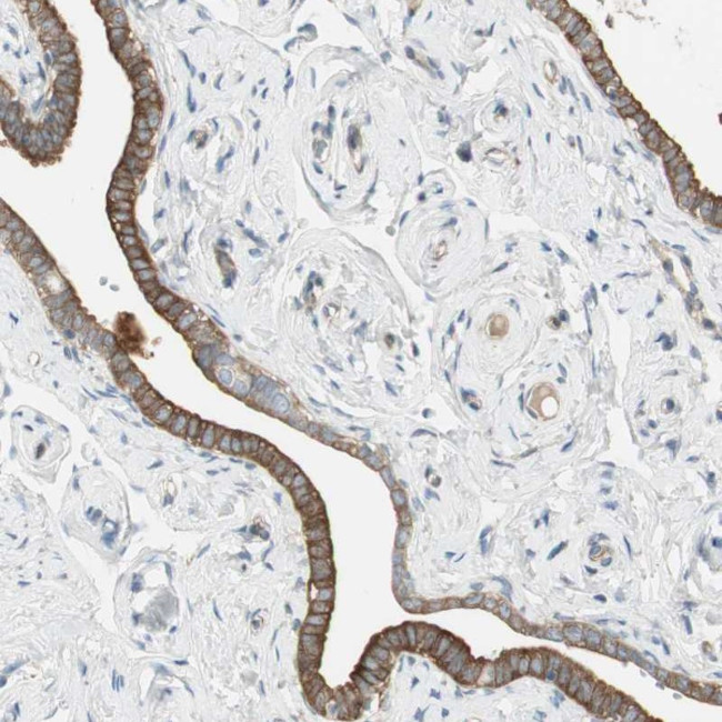 SALF Antibody in Immunohistochemistry (Paraffin) (IHC (P))