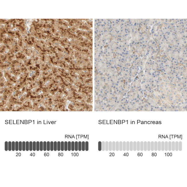 SELENBP1 Antibody in Immunohistochemistry (IHC)