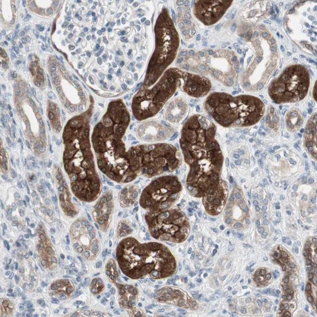 PDZK1 Antibody in Immunohistochemistry (Paraffin) (IHC (P))