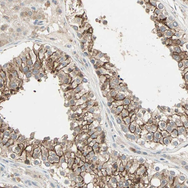 TTF2 Antibody in Immunohistochemistry (IHC)