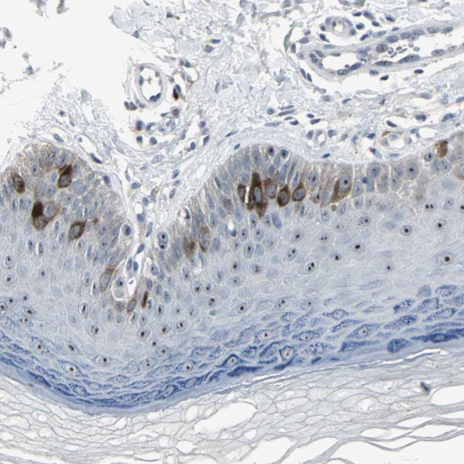 TACC3 Antibody in Immunohistochemistry (Paraffin) (IHC (P))