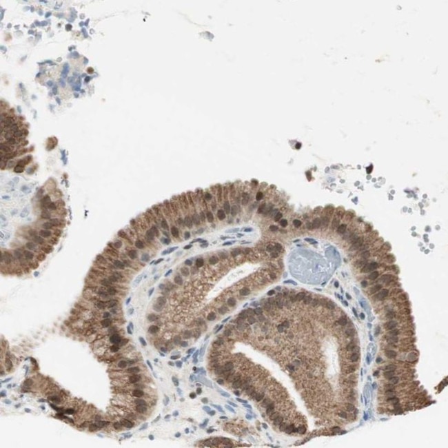 ZBTB17 Antibody in Immunohistochemistry (IHC)