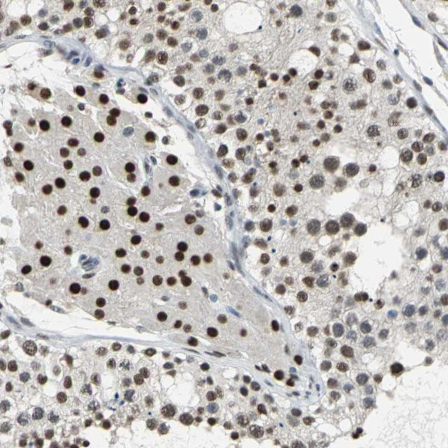 CCDC88C Antibody in Immunohistochemistry (Paraffin) (IHC (P))