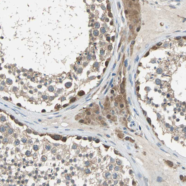 TRAK1 Antibody in Immunohistochemistry (Paraffin) (IHC (P))