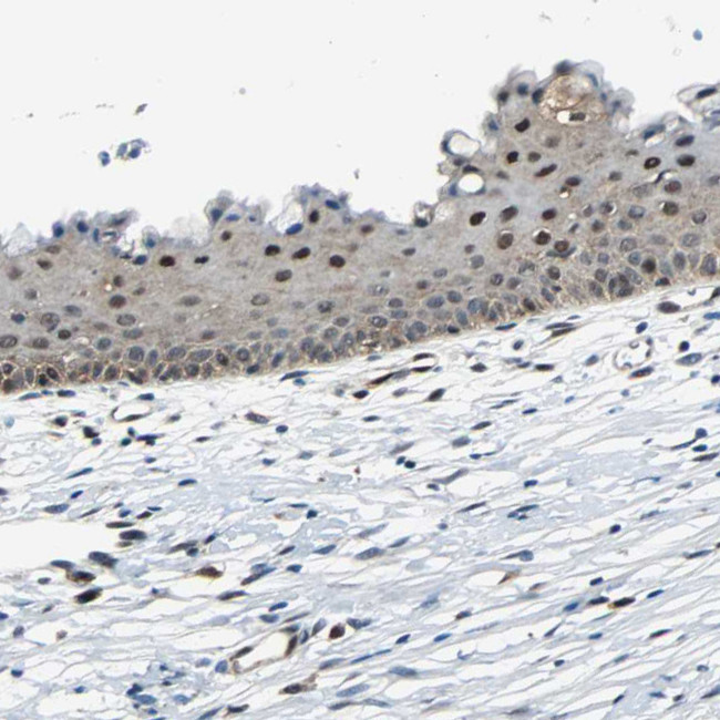 POLR3K Antibody in Immunohistochemistry (Paraffin) (IHC (P))