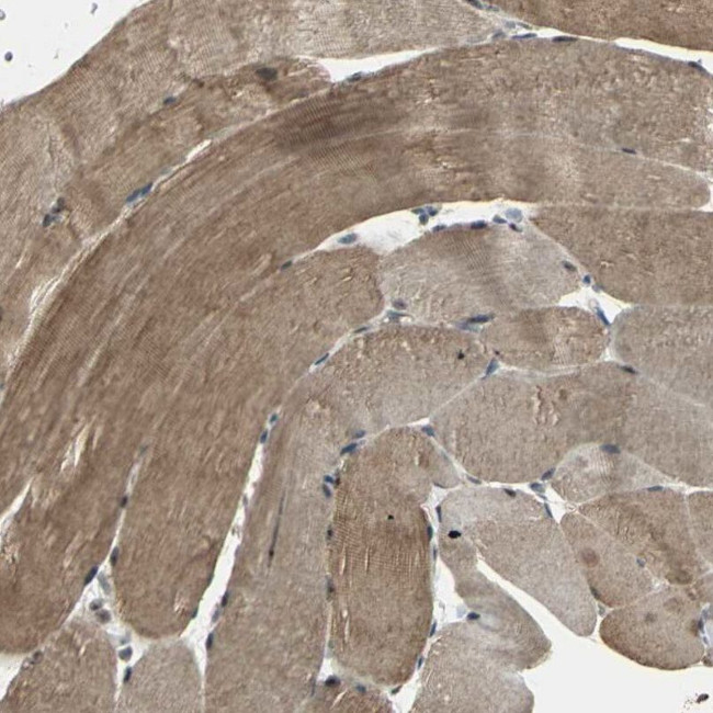 UCH37 Antibody in Immunohistochemistry (IHC)