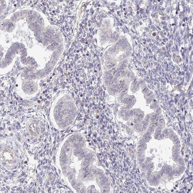 MYOM2 Antibody in Immunohistochemistry (Paraffin) (IHC (P))