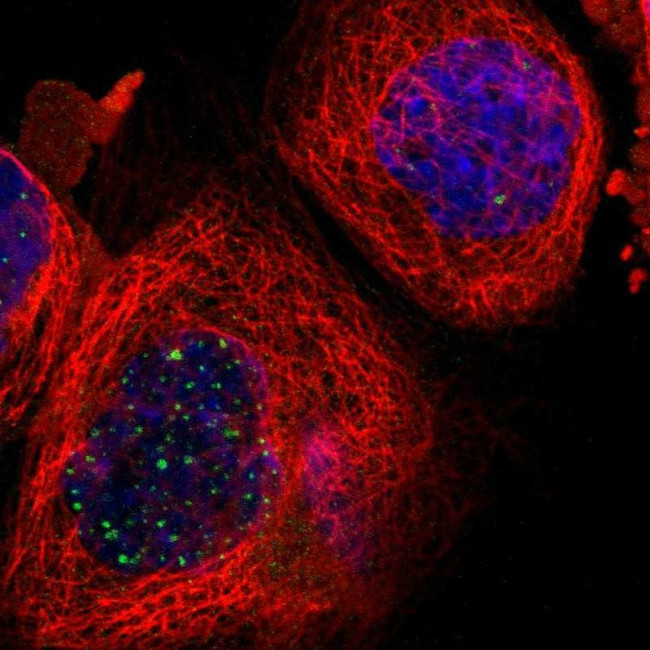 RPS13 Antibody in Immunocytochemistry (ICC/IF)