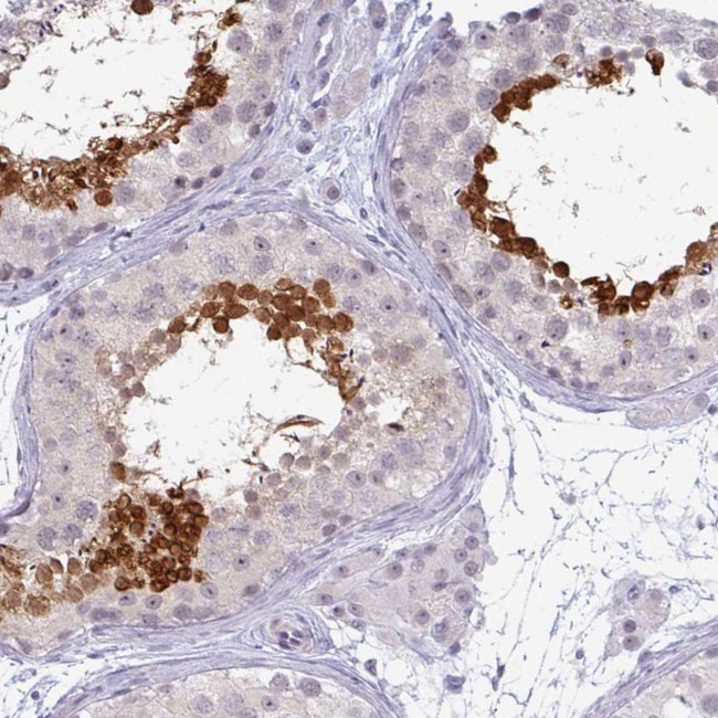 TEX33 Antibody in Immunohistochemistry (Paraffin) (IHC (P))