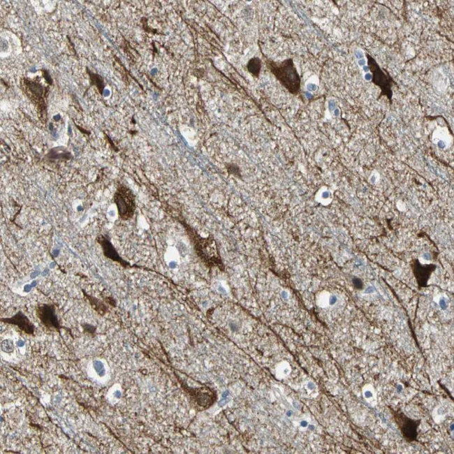PHF16 Antibody in Immunohistochemistry (Paraffin) (IHC (P))