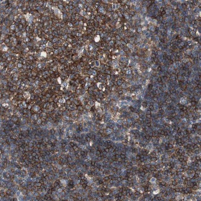SCIMP Antibody in Immunohistochemistry (Paraffin) (IHC (P))