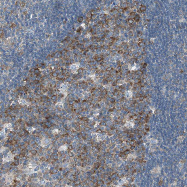 RPS12 Antibody in Immunohistochemistry (Paraffin) (IHC (P))