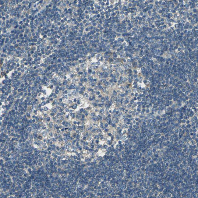 SCK Antibody in Immunohistochemistry (Paraffin) (IHC (P))