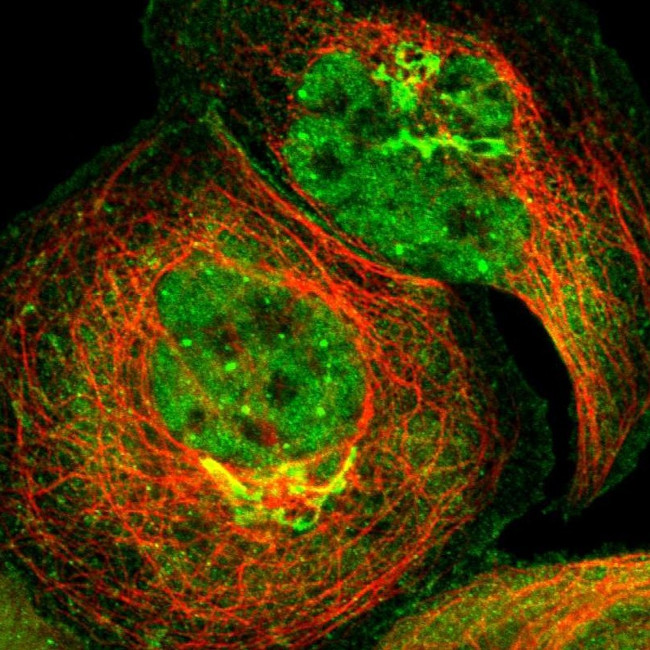ZNF18 Antibody in Immunocytochemistry (ICC/IF)