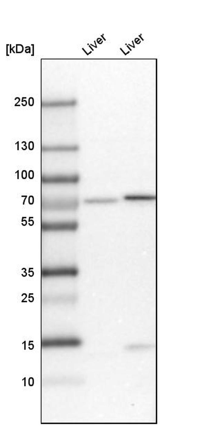 PDZK1 Antibody in Western Blot (WB)