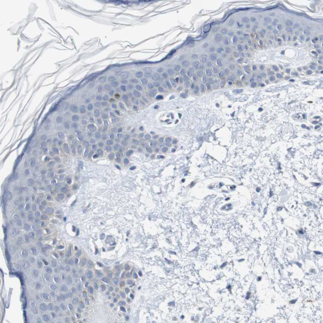 SOX30 Antibody in Immunohistochemistry (Paraffin) (IHC (P))