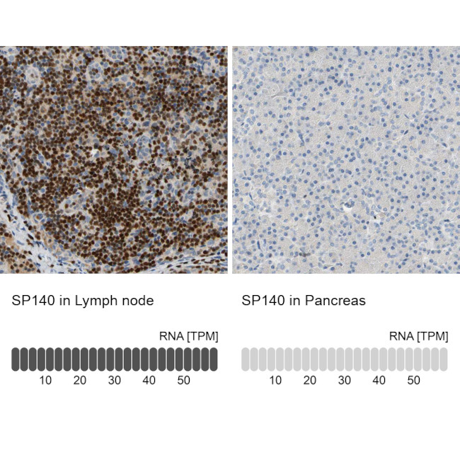 SP140 Antibody in Immunohistochemistry (IHC)
