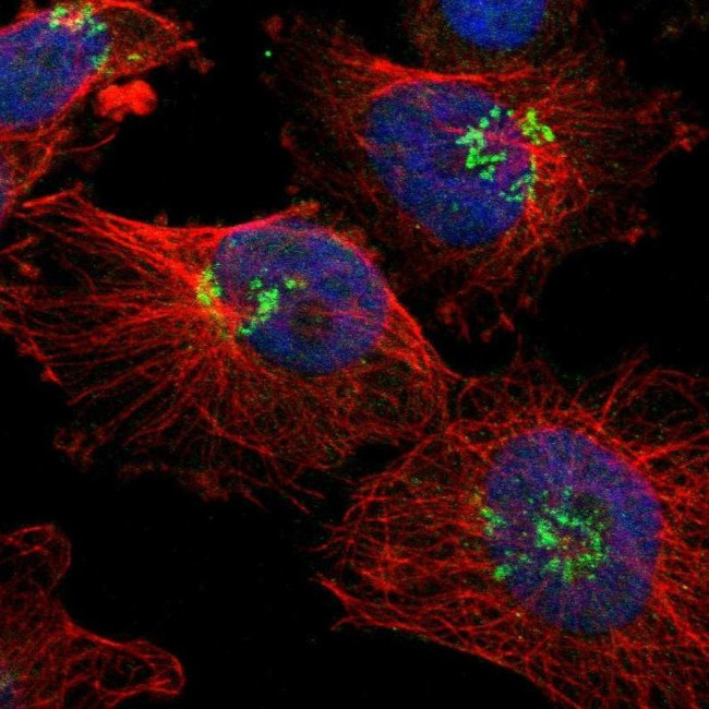 AJUBA Antibody in Immunocytochemistry (ICC/IF)