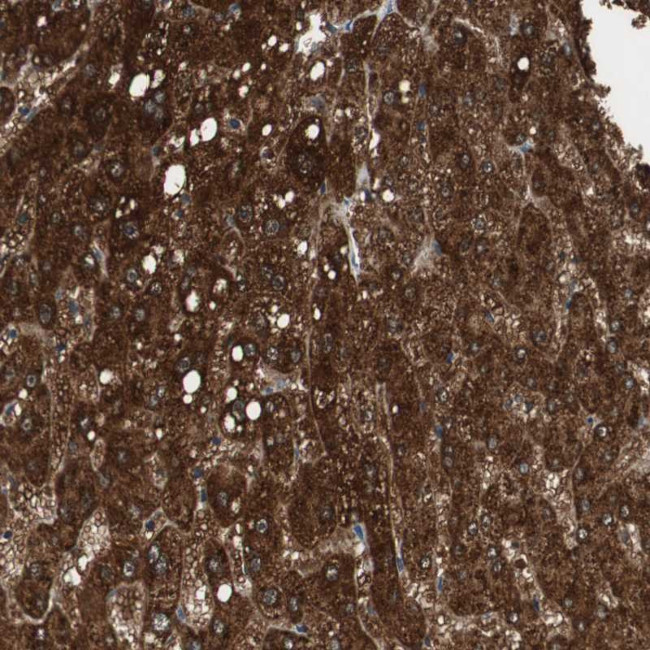 PI4KB Antibody in Immunohistochemistry (Paraffin) (IHC (P))