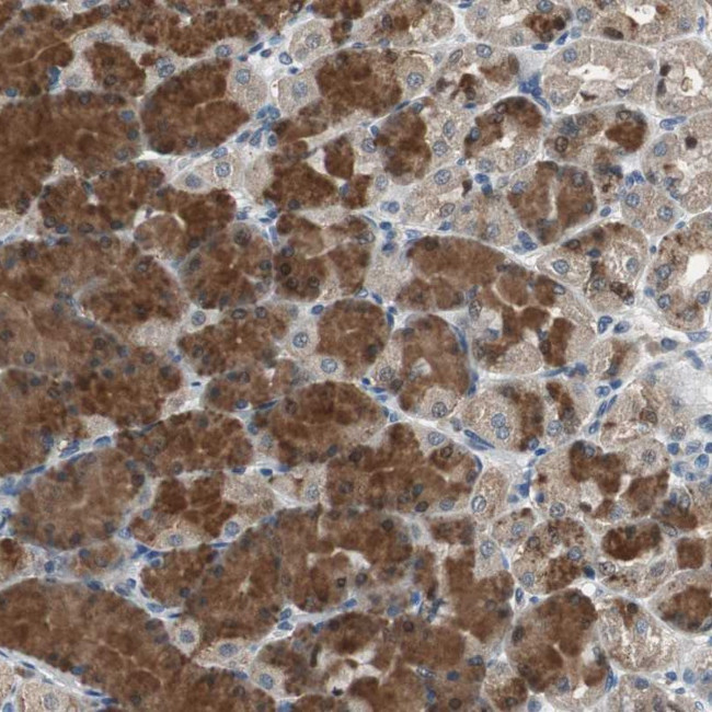 PI4KB Antibody in Immunohistochemistry (Paraffin) (IHC (P))
