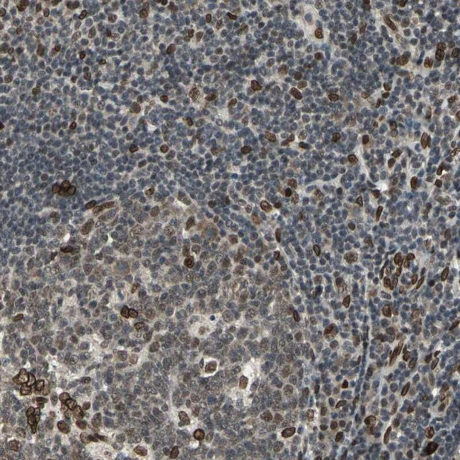 ISY1 Antibody in Immunohistochemistry (IHC)