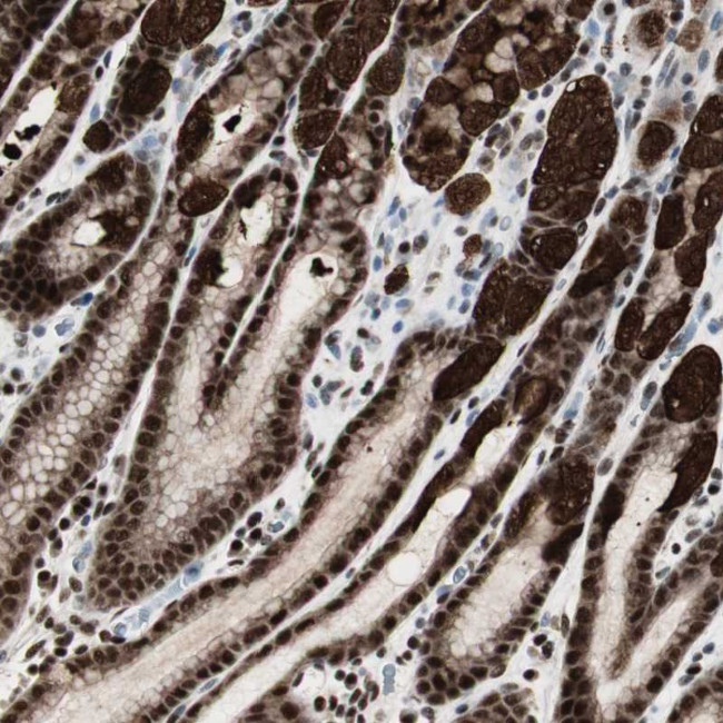 PARN Antibody in Immunohistochemistry (Paraffin) (IHC (P))