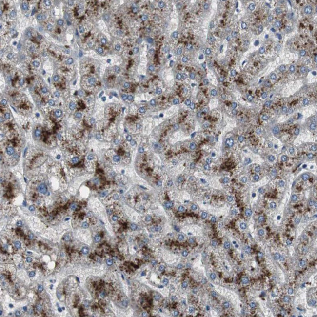 PCYT1B Antibody in Immunohistochemistry (Paraffin) (IHC (P))