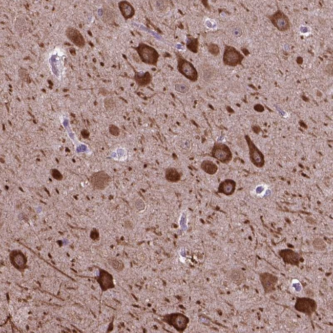 PIAS3 Antibody in Immunohistochemistry (Paraffin) (IHC (P))