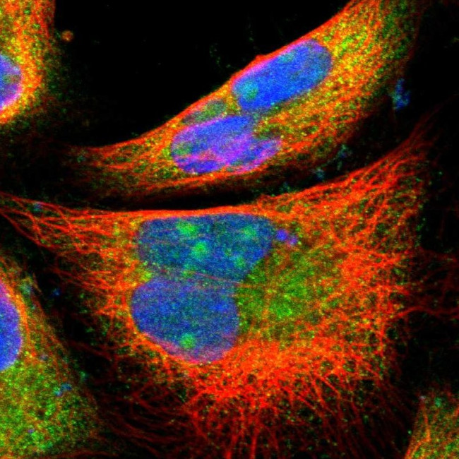 PFDN1 Antibody in Immunocytochemistry (ICC/IF)