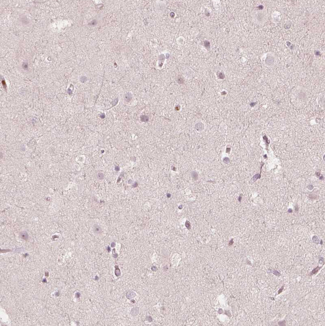 ACACB Antibody in Immunohistochemistry (Paraffin) (IHC (P))