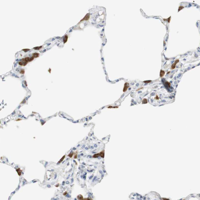 PI15 Antibody in Immunohistochemistry (Paraffin) (IHC (P))