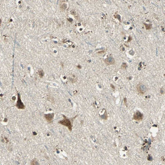 NIT1 Antibody in Immunohistochemistry (IHC)