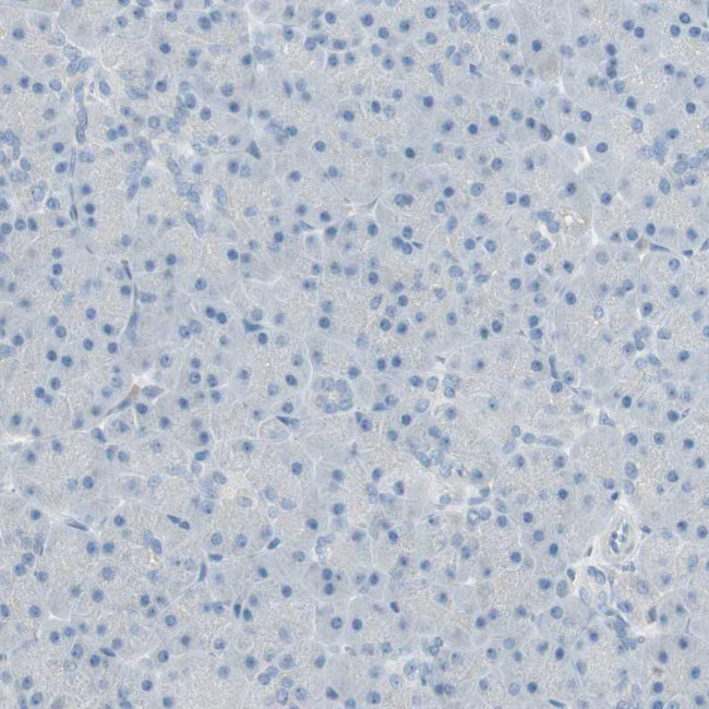 ITLN2 Antibody in Immunohistochemistry (Paraffin) (IHC (P))