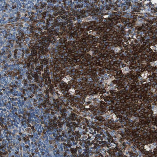 SWAP70 Antibody in Immunohistochemistry (Paraffin) (IHC (P))