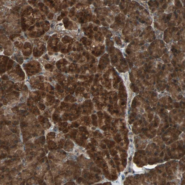 LAMTOR5 Antibody in Immunohistochemistry (Paraffin) (IHC (P))