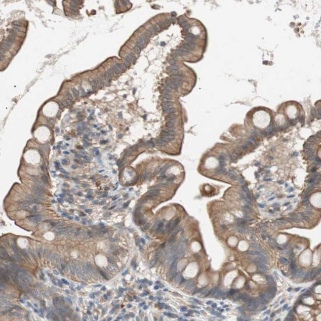 SMG1 Antibody in Immunohistochemistry (IHC)