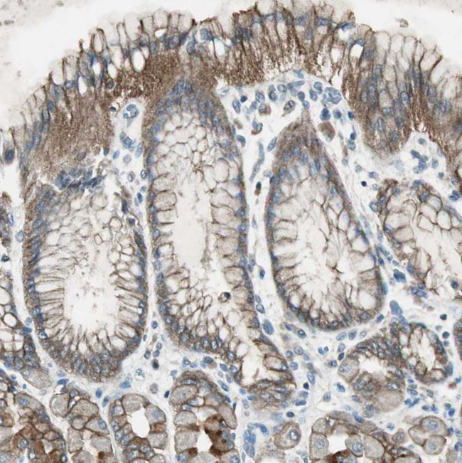 NKAIN1 Antibody in Immunohistochemistry (Paraffin) (IHC (P))