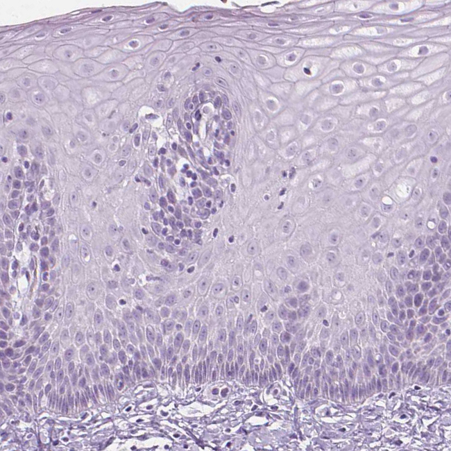 SCG3 Antibody in Immunohistochemistry (Paraffin) (IHC (P))